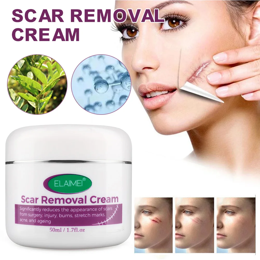 Scar Removal Cream For Acne Marks Burns Stretch Surgical Scars Promote New Skin Growth Treatment | Красота и здоровье