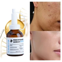 niacinamide whitening face serum cosmetics hyaluronic acid moisturizing nourish face care oil control anti acne repair skin care