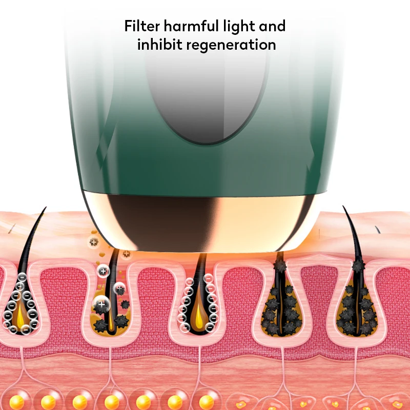 Лазерное удаление волос 990000 вссветильник эпилятор для женщин навсегда