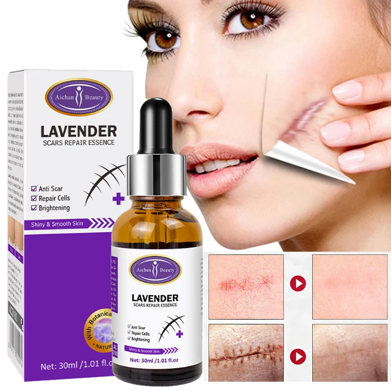 

Эссенция для восстановления шрамов, хирургические следы сгорания, увлажнение, выцветание, следы от акне, тонус раны, уход за кожей, 30 мл