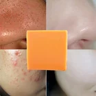 100 г, эфирное масло куркумы, мыло, очищающее питательное масло, контроль жирности, отбеливание, лечение акне шампунь для волос, мыло для тела и лица, уход за кожей