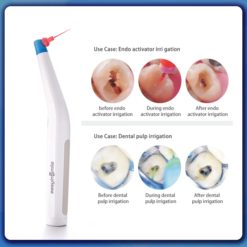 Ирригатор корневой системы с 60 эндодонтическими пилками и насадками|Файлы