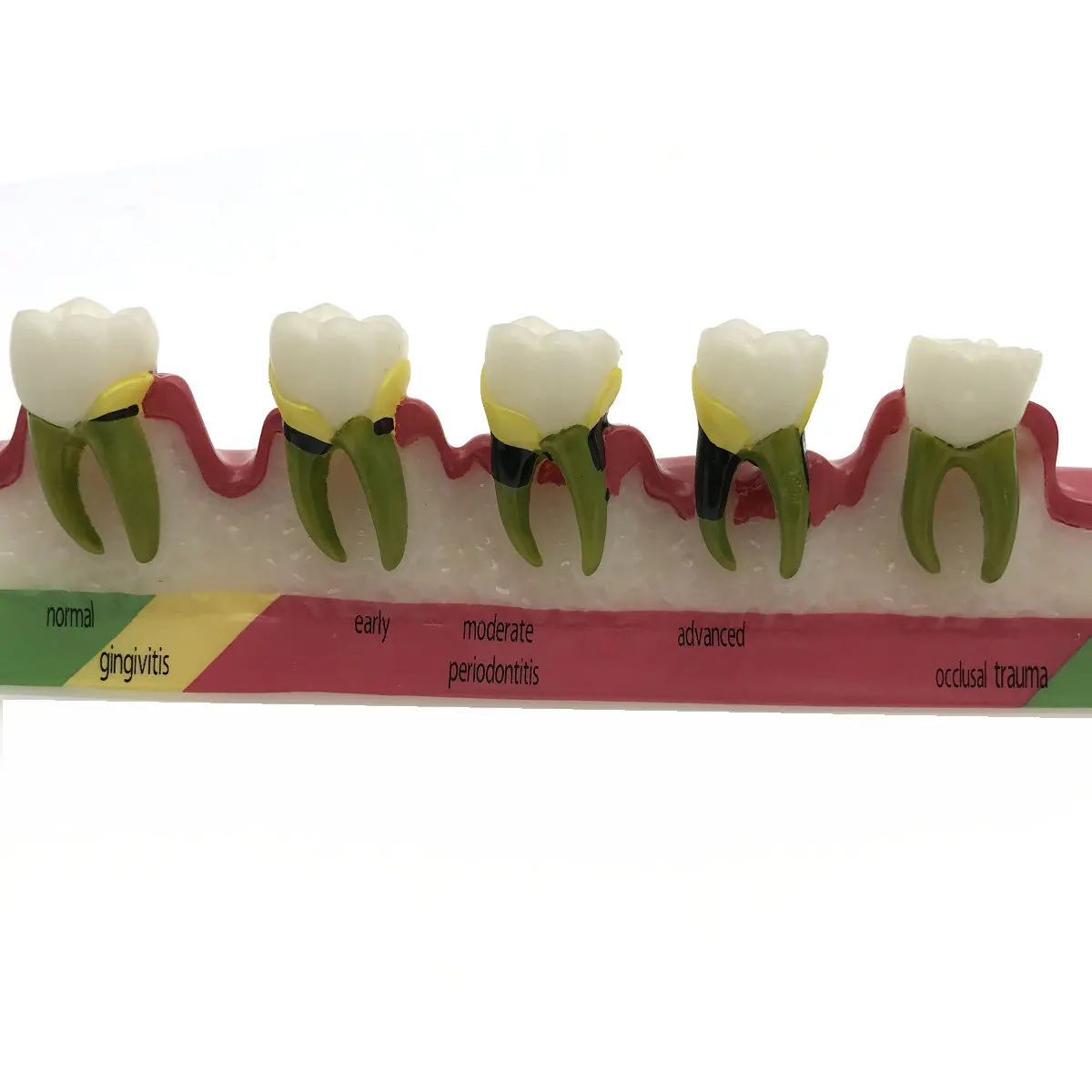 Стоматологический периодонтальный болезни разбирают зуб Typodont модель|model craft|model