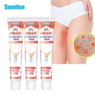 Антибактериальный крем для удаления запаха, 3 шт., мазь для васки, подмышек, интимный дезодорант, дерматита, бактериостезное масло