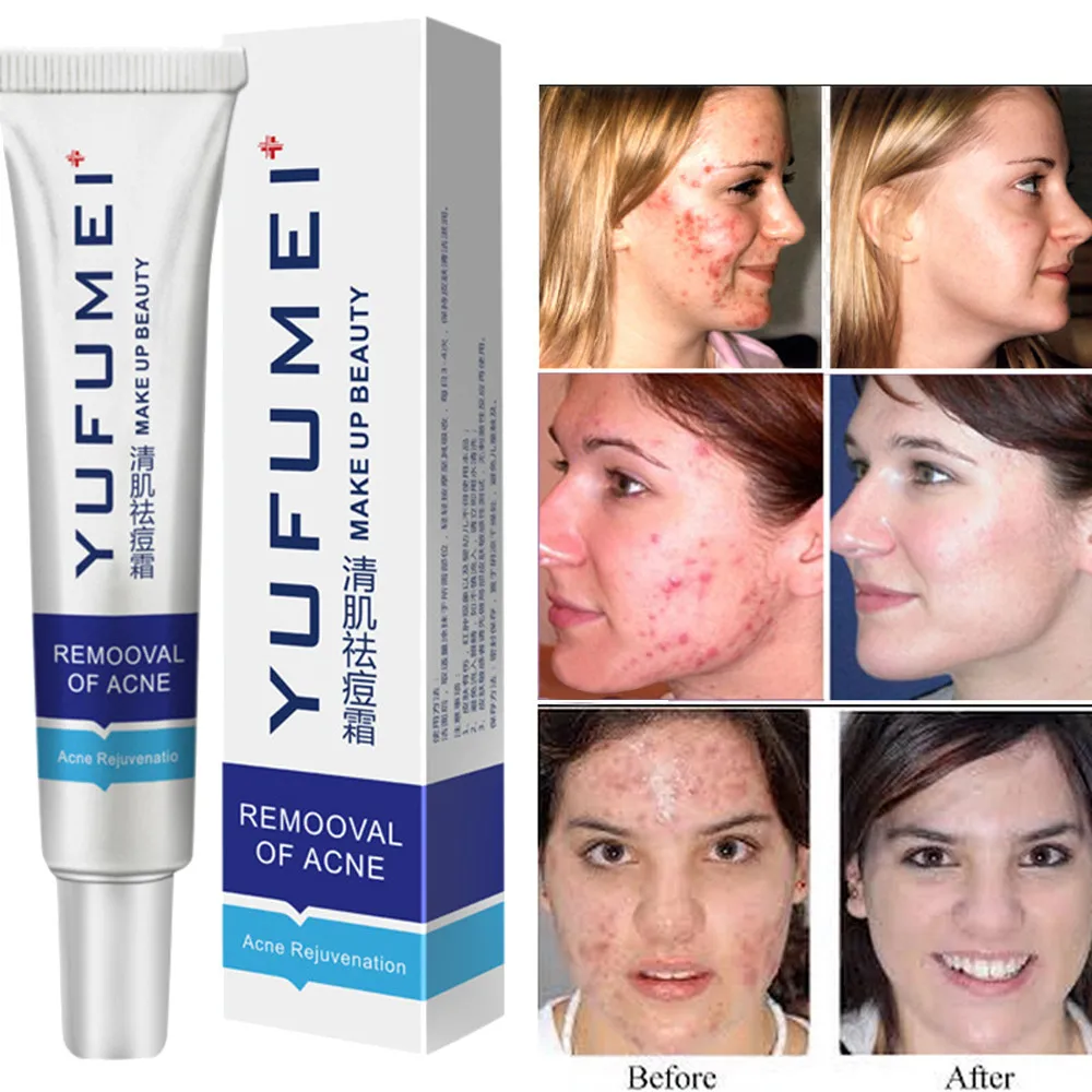 25 г крем для ухода за кожей лица акне контроль жирности косметический