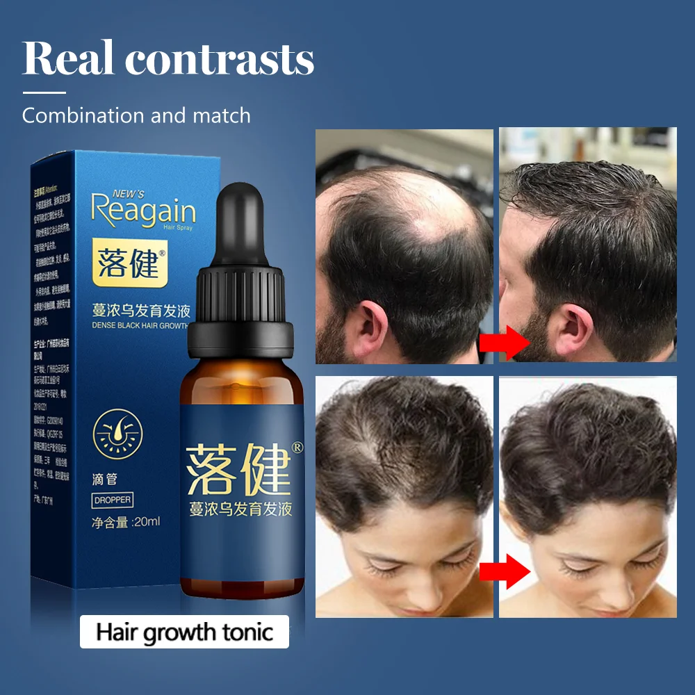 

Эссенция для быстрого роста волос масло для жидкости кожи головы продукты против выпадения волос лечение волос уход за волосами для мужчин и женщин восстановление волос