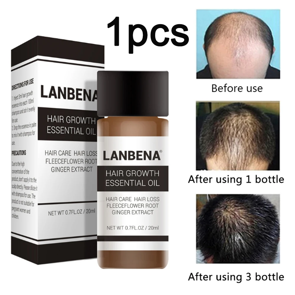 1pcs LANBENA 20 мл эссенция для роста волос Быстрый мощный Уход за волосами Эфирное Масло жидкое лечение Предотвращение выпадения волос для мужчин и женщин - Цвет: 1pcs