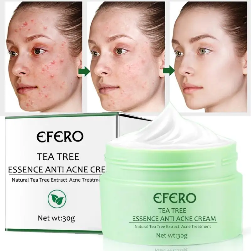 

EFERO Tea Tree Anti Acne Cream Get Rid Acne Scars Facial Spots Treatment Acne Oil Control Nourishing Whitening Facial Skin Care