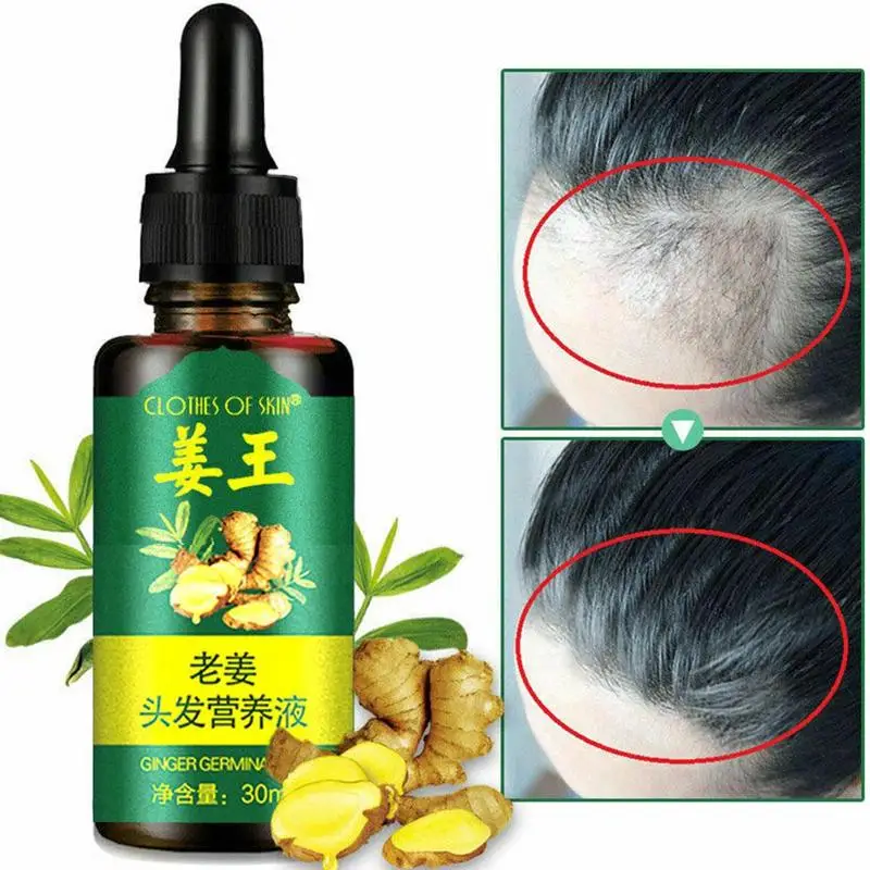 

30ml Ginger Essential Oil Hair Growth Essence Hair Loss Liquid Hair Growth Essence oil Dense Hair Fast Sunburst Grow
