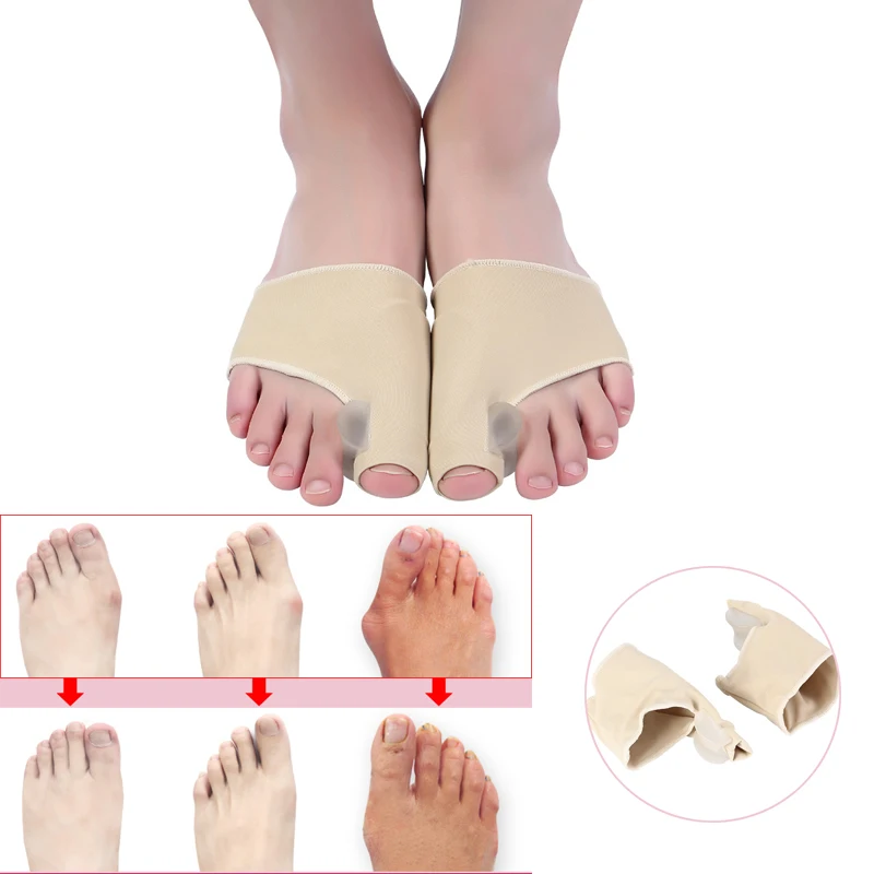 1 пара из дышащего материала с накатанной головкой Valgus протектор безболезненно