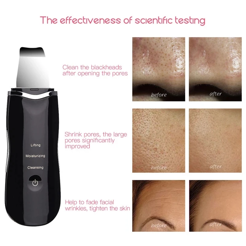 Ultrasonic Facial Skin Cleaning Device Scrubber USB Pore Cleanser Exfoliator 4 Modes Anion Machine for Care | Красота и здоровье
