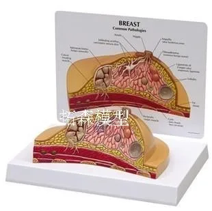 Breast disease Anatomy model Human Body Model ill/normal /lactation period free shipping | Medical Science