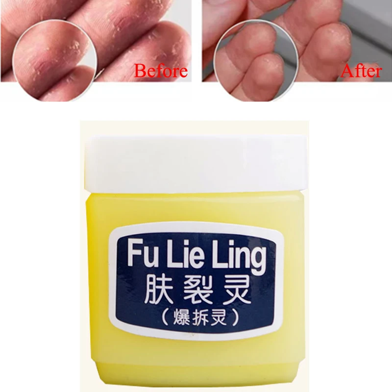 

Natural Cure Face Cream Prevent Skin From Crowfoot Cracks Moisturize Face Skin Frost Crack Prevention For The Winter Dry Skin