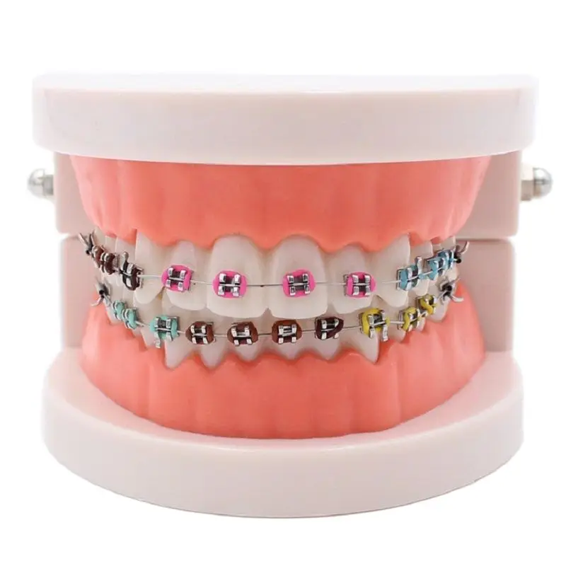 Modelo de tratamiento de ortodoncia Dental con soporte de cerámica de Metal Ortho, alambre de arco, lazos de ligadura de tubo bucal, herramientas de dentista de laboratorio