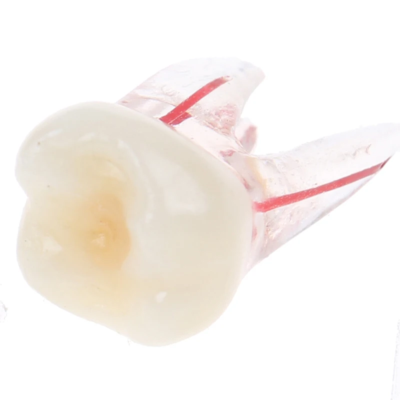 

1PCS 1:1 Resin Dental Endodontic Student Study Practice Model With Colored Root Canal And Pulp Transparent Without Files