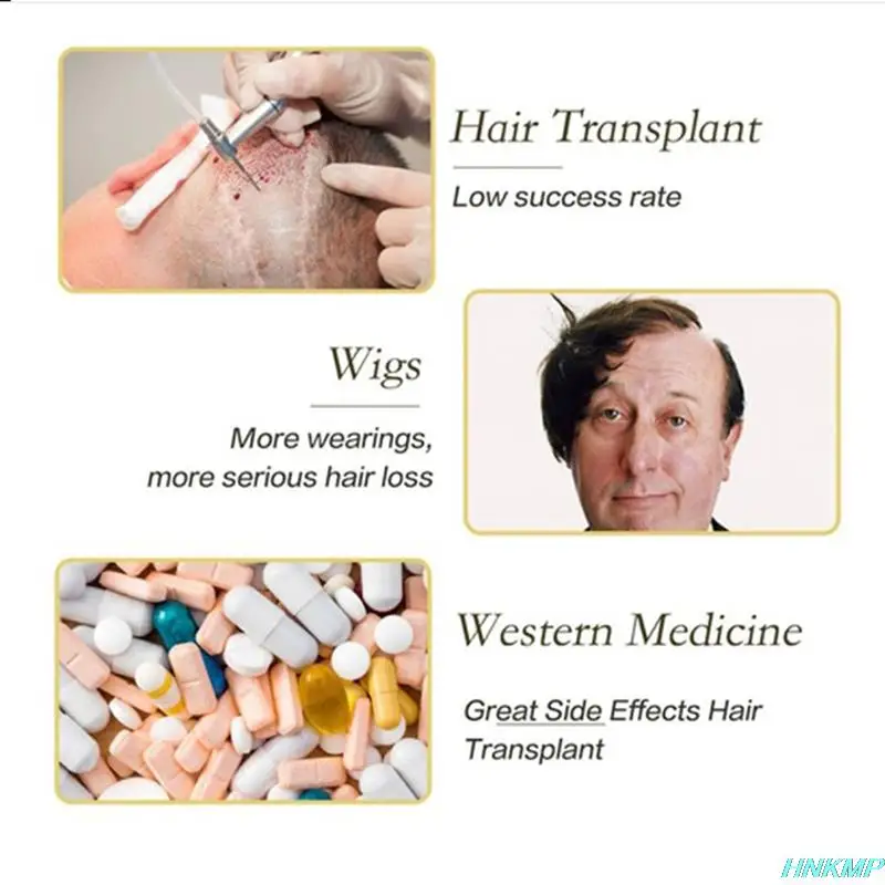 Новинка 2021 сыворотка для быстрого роста волос 20 мл жидкость предотвращения