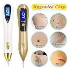 Ручка для удаления родинок, инструмент для удаления бородавок и плазмы, лазер для красоты, уход за кожей, этикетка на веснушки, веснушки, пятна темного возраста, тату, электрические наборы