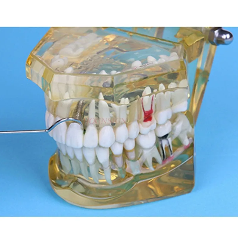 Зубочистка металлическая зубочистка из нержавеющей стали крюк для зубочистки