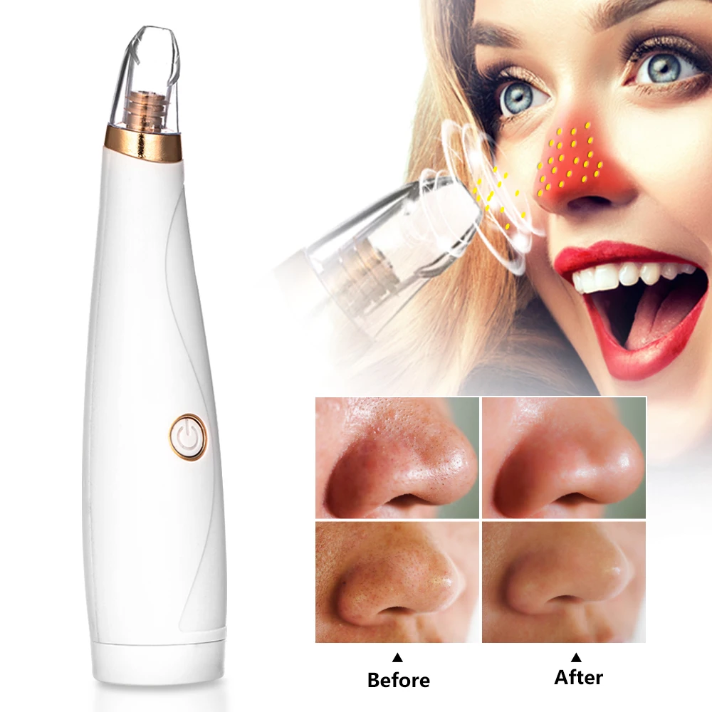 Новинка средство для удаления черных точек лица прыщей пор ухода за кожей