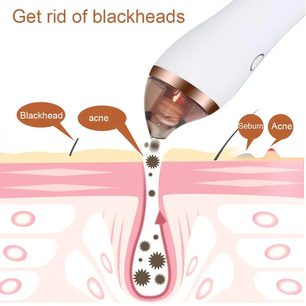 

4 in 1 Body Guasha Cupping Blackhead Remover Machine Vacuum Acne Pore Beauty Scraping Skin Cleansing Suction Deep Care K9N2