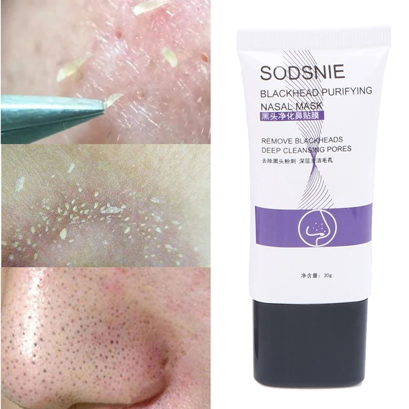 Blackhead удаление Глубокая чистка очищающий акне пилинг черная грязевая маска для