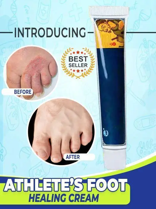 

Athlete's foot therapy cream herbal milk folk prescription beriberi, foot odor, foot itching, foot cracking, rotten foot,