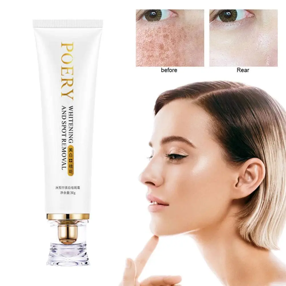 

30G Whitening Cream Removes Chloasma Acne Spot Pigment Melanin Dark Spot Pigmentation Moisturizing Gel Skin Care