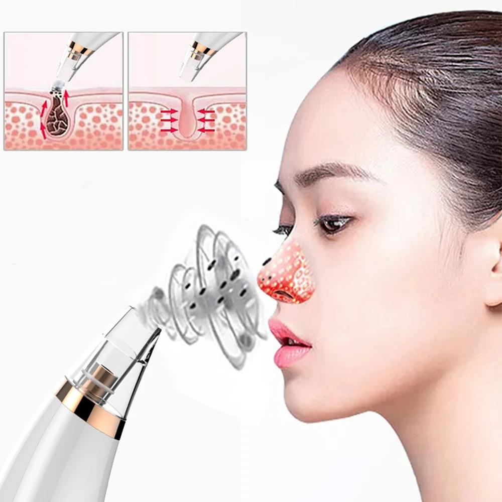 Электрический прибор для удаления черных точек с черными точками лица и пор