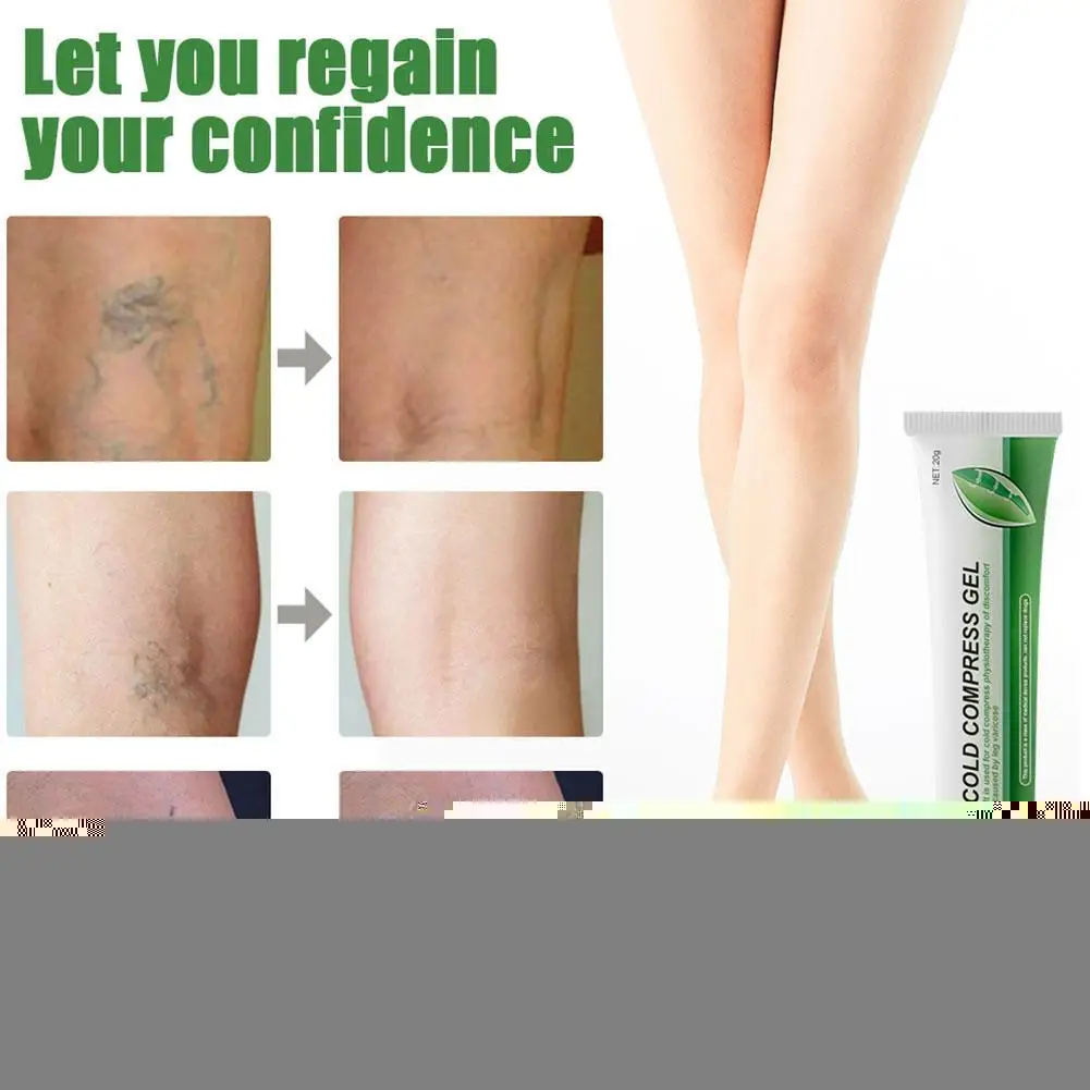 

Varicose Veins Gel And Treatment Pen Effective Relieve Treatment Natural G9A4 Angiitis Phlebitis Veins Cream Varicose Herba H3P8