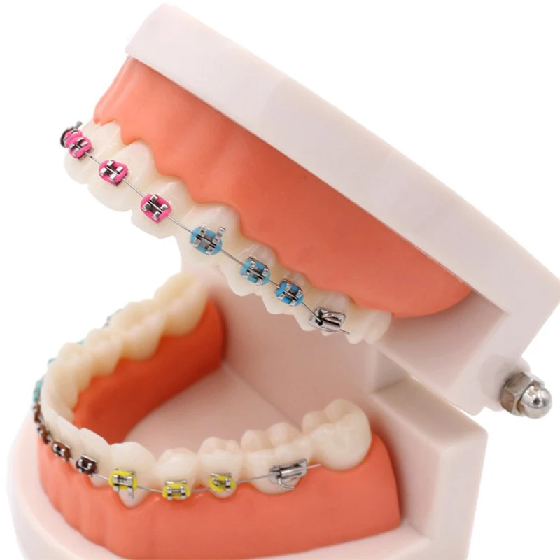 1 шт. Стоматологическая модель зуба с кронштейном Ортодонтическая обучающая