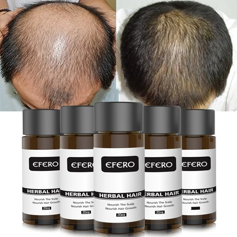 

Effective Hair Growth Serum Fast Thick for Hair Essential Oils Hair Loss Damaged Hair Repair Natural Hair Care Products