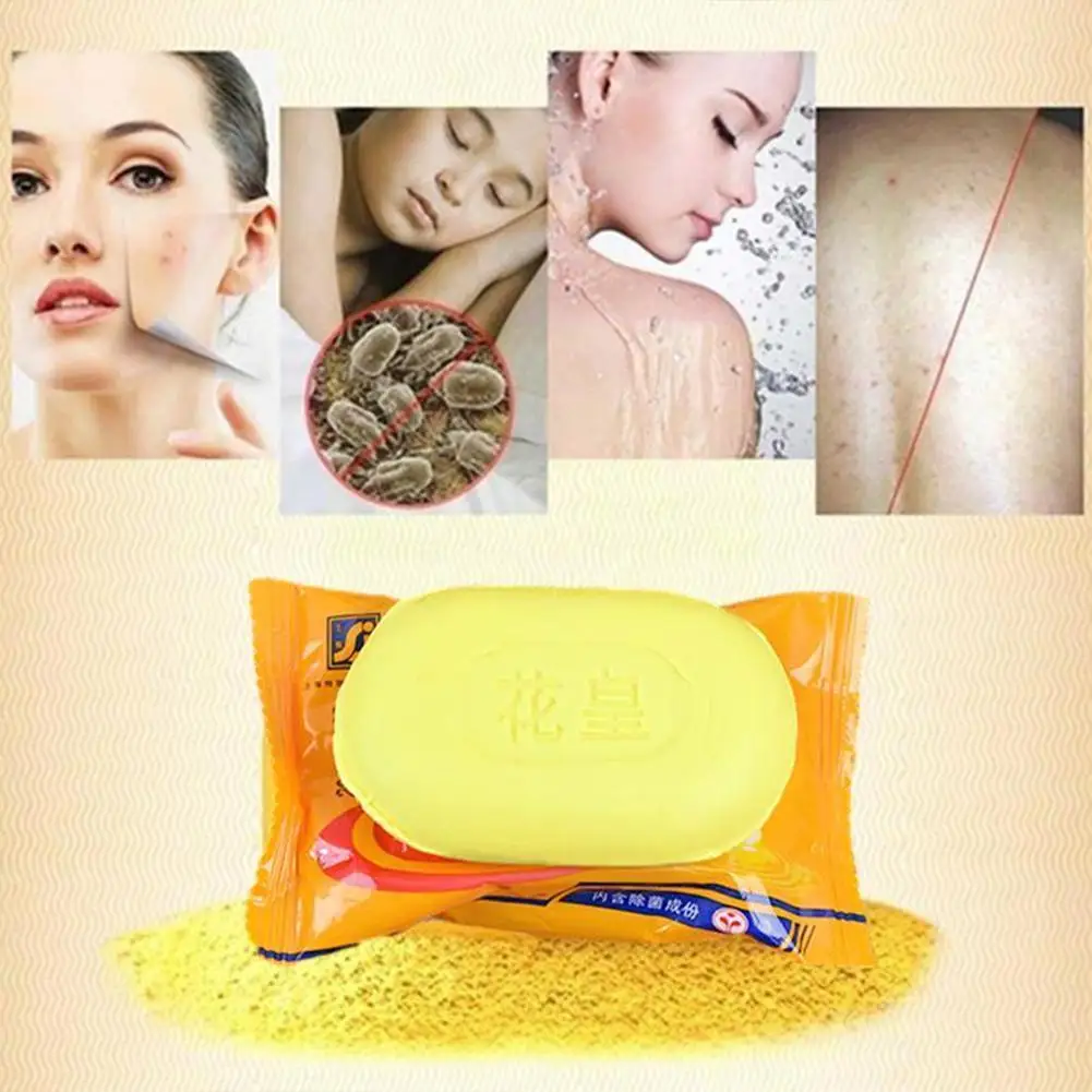 

Back Cleansing Sulfur Soap Acne Psoriasis Sebum Eczema Bath Antifungal Soap H1D9