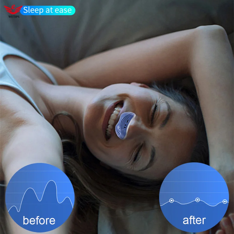 

WETIPS Electric Anti Snoring Men Breathable Anti-Snoring Nose Anti Ronco Apneia Snoring Device Antisnoring Antironquidos Hombre