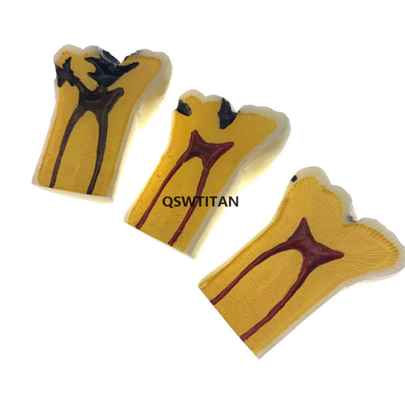 1 шт. съемные зубы для зубов размер 4:1|Стоматологическая учебная модель| |