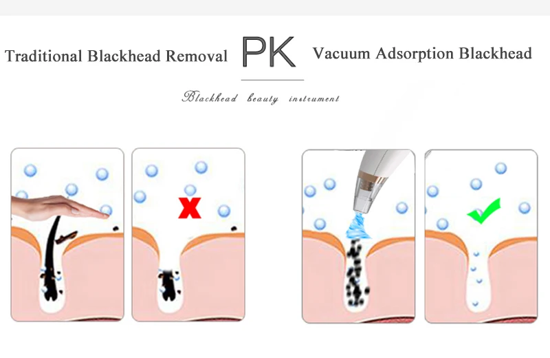 Blackhead Remover Vacuum Suction Face Deep Pore Cleaner Electric Acne Pimple Remover Tool Dark Spot Remover for Face Beauty Tool
