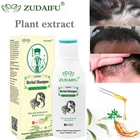 Zudaifu псориаз экзема для волос травяной шампунь лечение женьшеня клещ для роста и удаления волос Антибактериальная сыворотка 120 мл