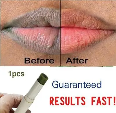 

Pink Fresh Lightening Lip Cream Treatment to Remove Dark Lips.