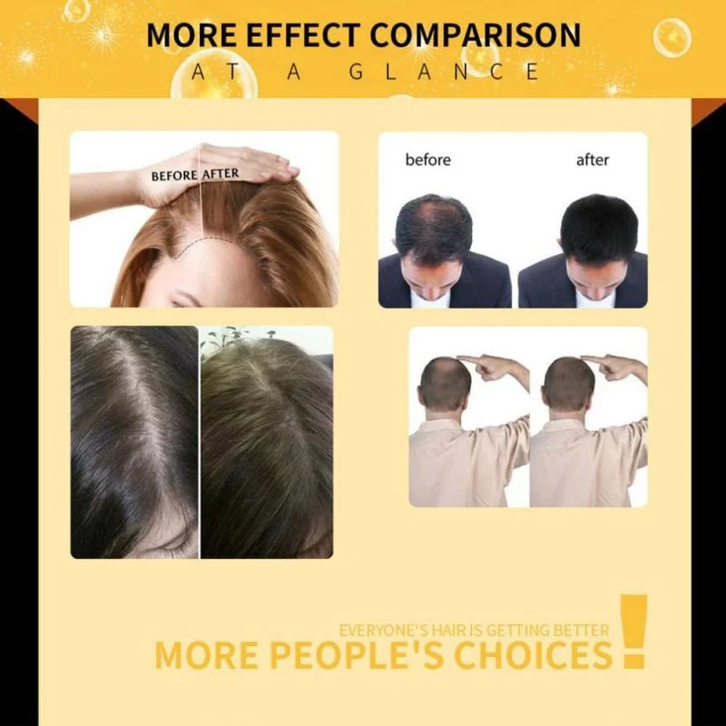 Имбирные эфирные масла для роста волос против выпадения жидкие продукты