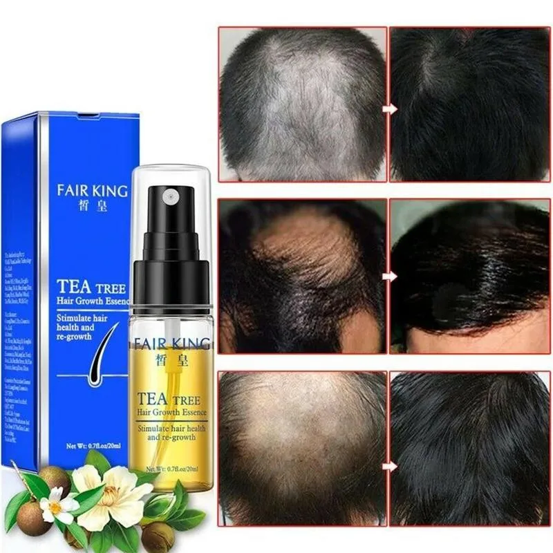 Эфирные масла для роста волос уход за волосами эссенция чайного дерева Подлинная