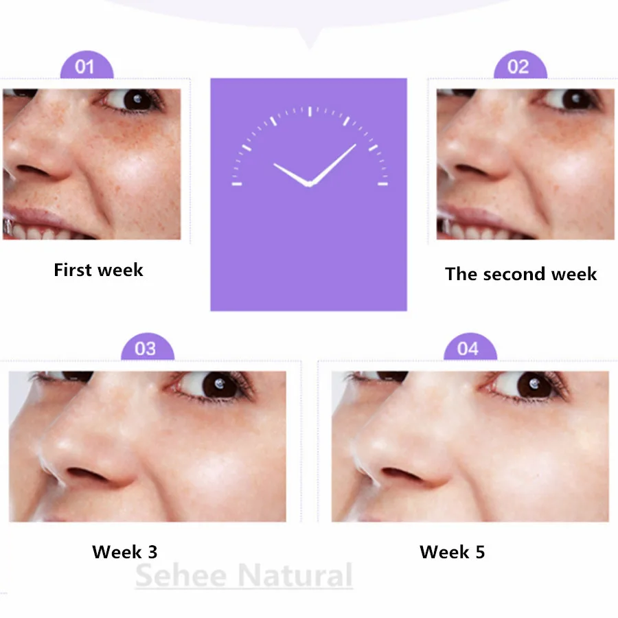 Рисунок 4 - Арбутин крем от веснушек стерилизации