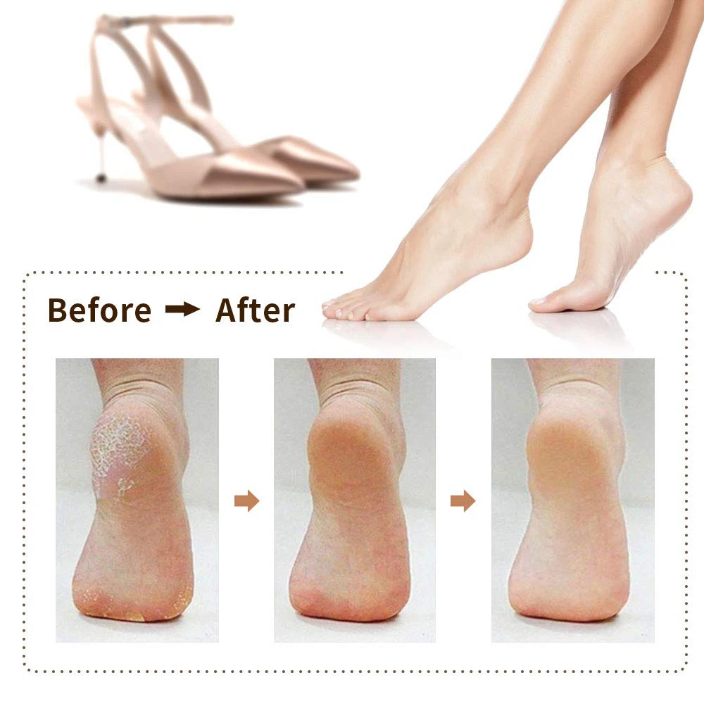 Электрическая пилка для ног