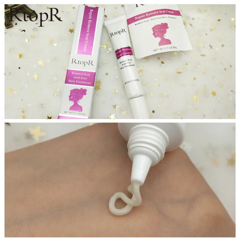 

RtopR brand remove Scar Anti Scar skin Treatment repair remove scar cream