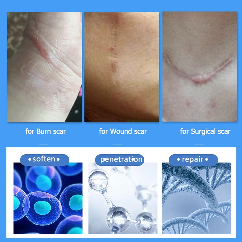 Youhekang 20 г медицинский гель для удаления рубцов мазь лица тела акне пятен крем