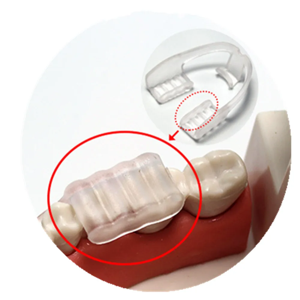 2pcs Stop Teeth Grinding Tooth Clenching Mouth Guard Prevent Night Bruxism Splint Sleep Aid Eliminates With Case Box#20