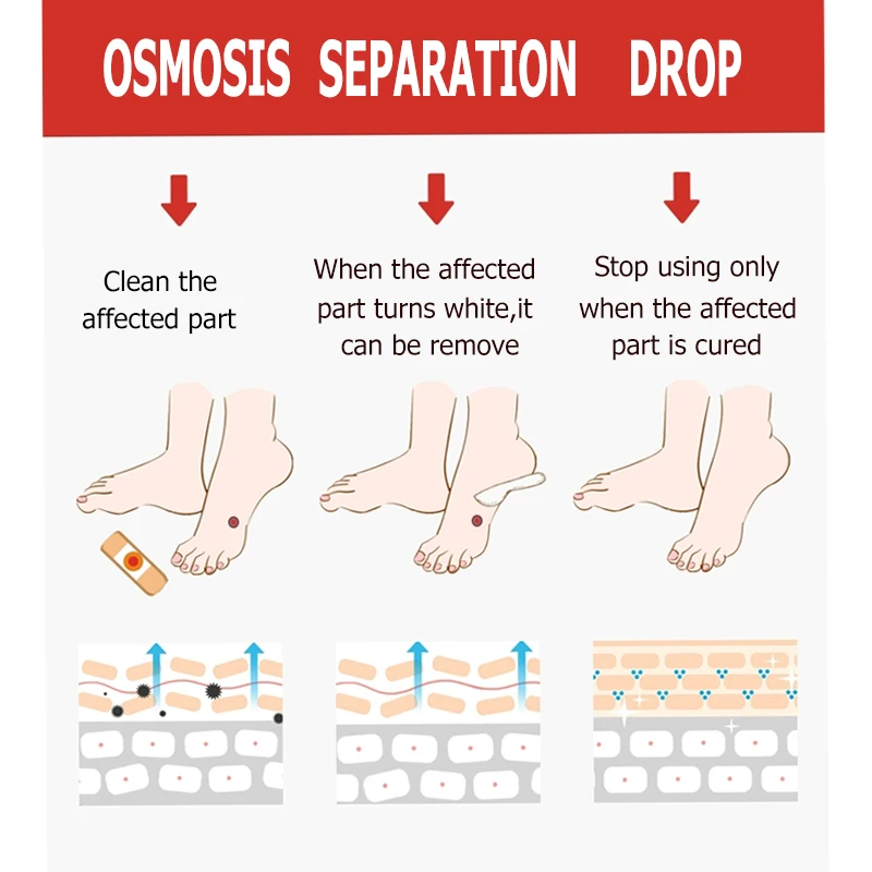 

24pcs Medical Plaster Foot Corn Removal Warts Thorn Patch Curative Patches Calluses Callosity Detox Foot Pads Toe Patch A293