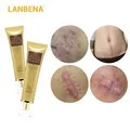 LANBENA губка для ванны, щетка для душа, отшелушивающая щетка для удаления грязи, чистящее средство, массажный Ультра мягкий для ребенка