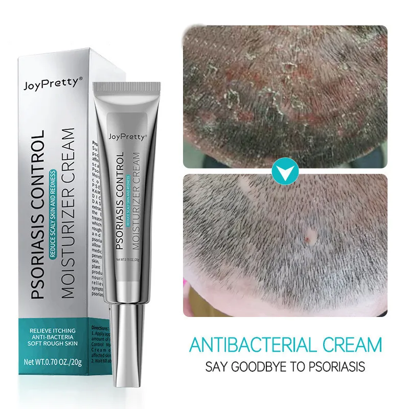 

Skin Ringworm King Ointment To Treat Skin Itching and Antipruritic Ointment To Remove Psoriasis Spots Fresh Ointment