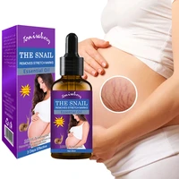 stretch marks remover essential oil scars acne stretch marks treatment maternity repair anti aging anti winkles firming body
