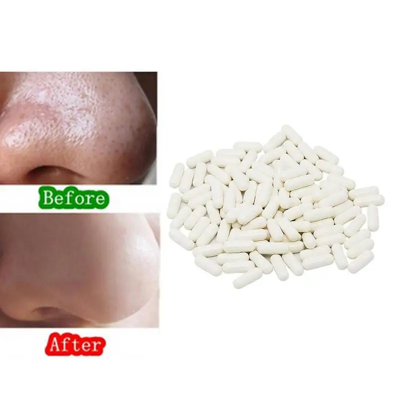 20 шт./упак. капсулы для очистки порошка удаления прыщей и сокращения пор контроль