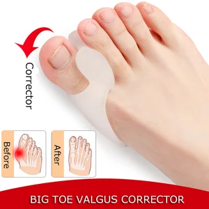 Устройство силиконовые гелевые сепараторы для пальцев ног мягкие ортопедические носилки стельки для снятия боли ортопедические стельки для ног